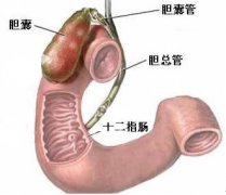 十二指肠炎怎么治疗好